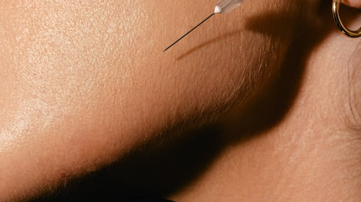 These 3 injectables should be on your pre-holiday list.