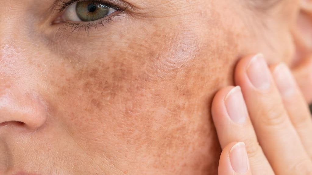Dubai summer is over. Your skin is still dealing with it.