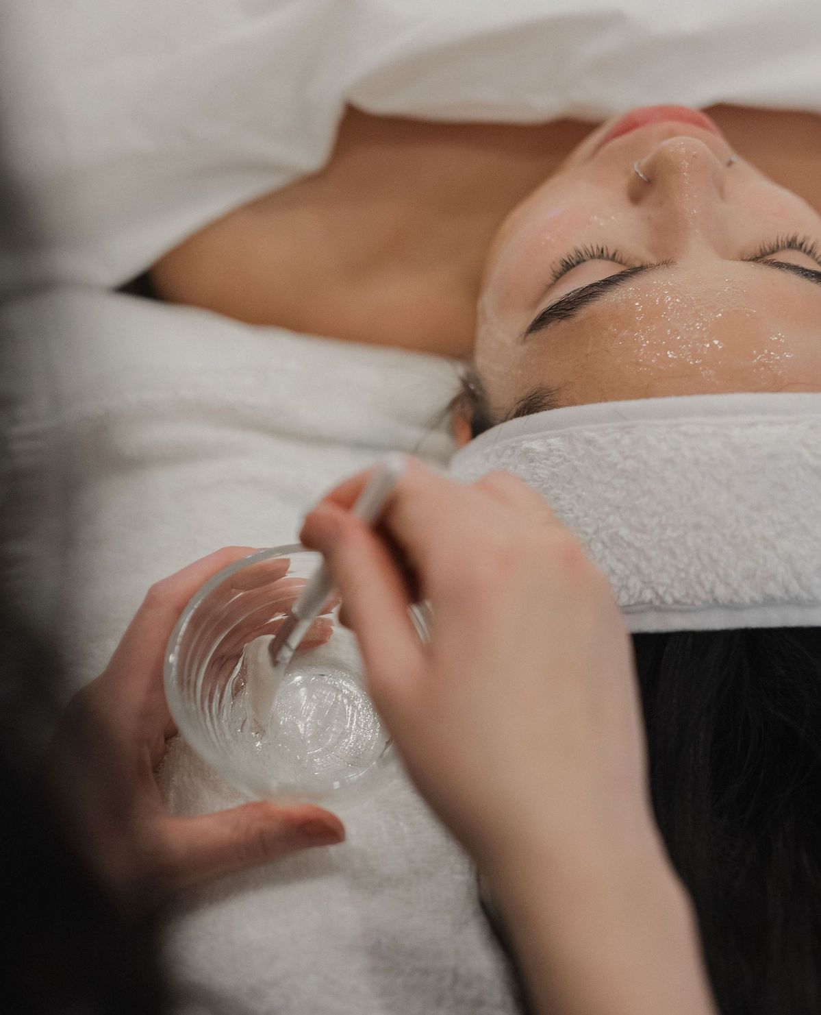 Your skin holds years of Dubai sun. A chemical peel helps you shed them.