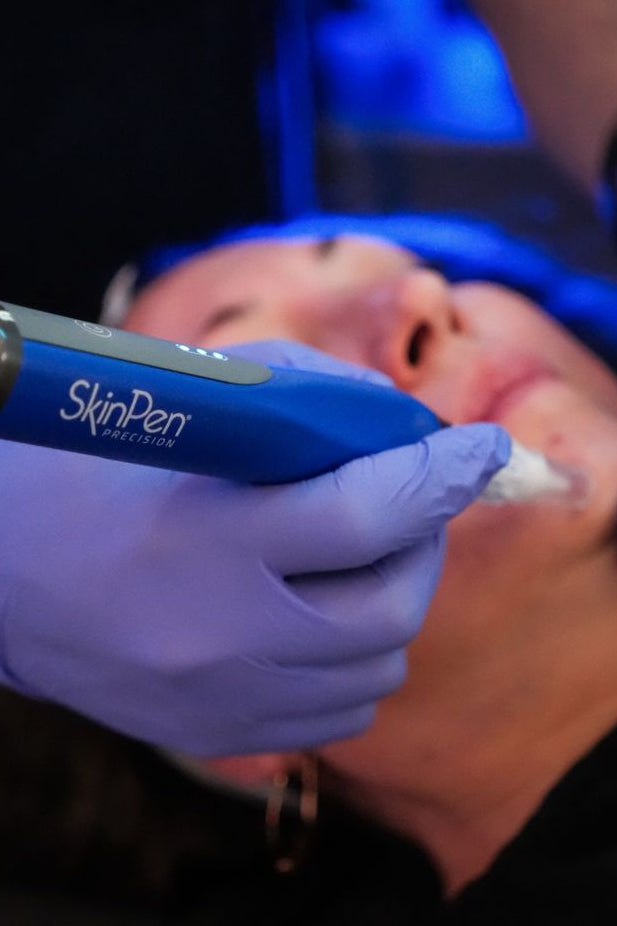 Your skin has the ability to repair and renew itself. SkinPen just gives it the signal.